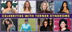 Celebrities with Turner Syndrome: A Compilation