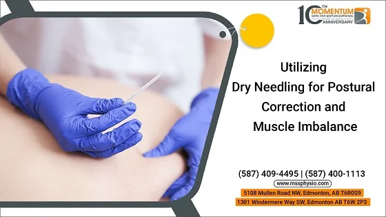 Utilizing Dry Needling for Postural Correction and Muscle Imbalance