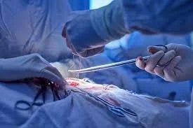 When is Vascular Surgery Medically Necessary?